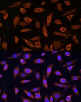 Immunocytochemistry/Immunofluorescence: MOB4A/MOBKL1B Antibody [NBP2-95097] - Analysis of L929 cells using MOB4A/MOBKL1B at dilution of 1:100. Blue: DAPI for nuclear staining.