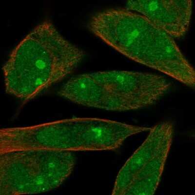 Immunocytochemistry/Immunofluorescence: MOBKL1B Antibody [NBP2-57643] - Staining of human cell line RH-30 shows localization to nucleus, nucleoli & cytosol.
