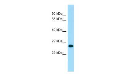 Western Blot: MOBKL1B Antibody [NBP3-09468] - Western blot analysis of MOBKL1B in Fetal Heart as a positive control. Antibody dilution at 1.0 ug/ml