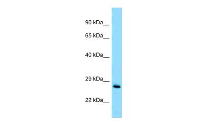 Western Blot: MOBKL1B Antibody [NBP3-09469] - Western blot analysis of MOBKL1B in Jurkat Whole Cell. Antibody dilution at 1.0 ug/ml