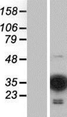 Western Blot: MOBKL2C Overexpression Lysate (Adult Normal) [NBP2-04610] Left-Empty vector transfected control cell lysate (HEK293 cell lysate); Right -Over-expression Lysate for MOBKL2C.