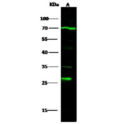 Western Blot: MOBKL3 Antibody [NBP2-99981] - Anti-MOBKL3 rabbit polyclonal antibody at 1:500 dilution. Lane A: HT-29 Whole Cell Lysate. Lysates/proteins at 30 ug per lane. Secondary Goat Anti-Rabbit IgG H&L (Dylight 800) at 1/10000 dilution. Developed using the Odyssey technique. Performed under reducing conditions. Predicted band size: 26 kDa. Observed band size: 26 kDa (We are unsure as to the identity of these extra bands).