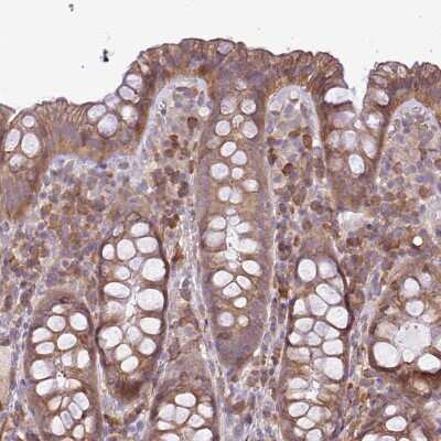 Immunohistochemistry-Paraffin: MOCS3 Antibody [NBP2-14244] - Staining of human rectum shows moderate cytoplasmic positivity in glandular cells.