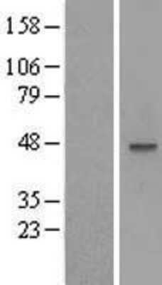 Western Blot: MOCS3 Overexpression Lysate (Adult Normal) [NBL1-13176] Left-Empty vector transfected control cell lysate (HEK293 cell lysate); Right -Over-expression Lysate for MOCS3.