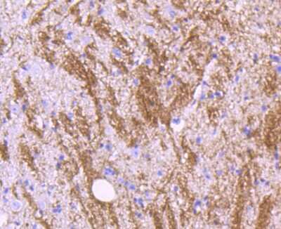 Immunohistochemistry-Paraffin: MOG Antibody (JM23-06) [NBP2-66957] - Analysis of paraffin-embedded mouse spinal cord tissue using anti-Myelin oligodendrocyte glycoprotein antibody. Counter stained with hematoxylin.