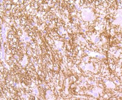 Immunohistochemistry-Paraffin: MOG Antibody (JM23-06) [NBP2-66957] - Analysis of paraffin-embedded rat spinal cord tissue using anti-Myelin oligodendrocyte glycoprotein antibody. Counter stained with hematoxylin.