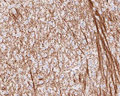 Immunohistochemistry-Paraffin: MOG Antibody (JM23-06) [NBP2-66957] - Analysis of paraffin-embedded mouse brain tissue using anti-MOG antibody. The section was pre-treated using heat mediated antigen retrieval with Tris-EDTA buffer (pH 8.0-8.4) for 20 minutes.The tissues were blocked in 5% BSA for 30 minutes at room temperature, washed with ddH2O and PBS, and then probed with the primary antibody (1/200) for 30 minutes at room temperature. The detection was performed using an HRP conjugated compact polymer system. DAB was used as the chromogen. Tissues were counterstained with hematoxylin and mounted with DPX.