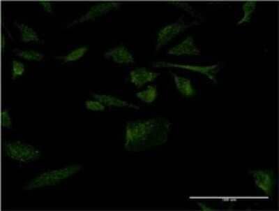 Immunocytochemistry/Immunofluorescence: MOG1 Antibody (1H4) [H00029098-M02] - Analysis of monoclonal antibody to RANGRF on HeLa cell . Antibody concentration 10 ug/ml.