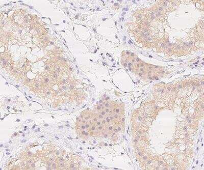 Immunohistochemistry-Paraffin MOG1 Antibody