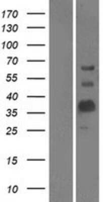 Western Blot: MOG Overexpression Lysate [NBP2-04536] - Left-Empty vector transfected control cell lysate (HEK293 cell lysate); Right -Over-expression Lysate for MOG.