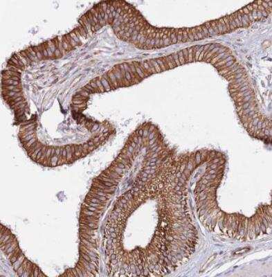 Immunohistochemistry-Paraffin: MOGAT1 Antibody [NBP2-14245] - Staining of human gallbladder shows strong cytoplasmic and membranous positivity in glandular cells.