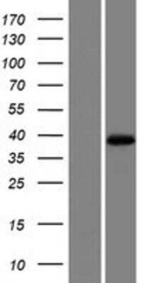 Western Blot: MOGAT1 Overexpression Lysate (Adult Normal) [NBP2-05739] Left-Empty vector transfected control cell lysate (HEK293 cell lysate); Right -Over-expression Lysate for MOGAT1.