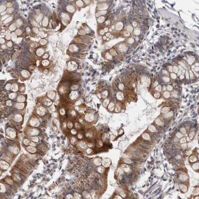 Immunohistochemistry-Paraffin: MOGAT2 Antibody [NBP1-85230] - Staining of human small intestine shows strong cytoplasmic positivity in glandular cells.