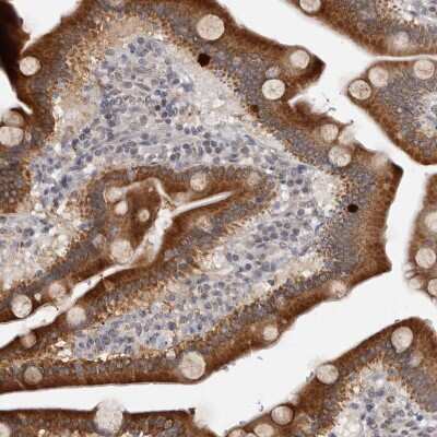 Immunohistochemistry-Paraffin: MOGAT2 Antibody [NBP1-85230] - Staining of human duodenum shows strong cytoplasmic positivity in glandular cells.