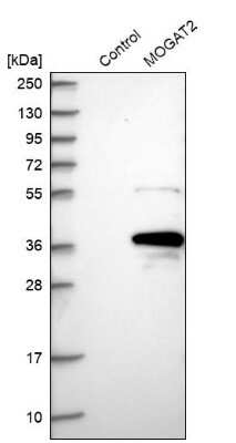 Western Blot MOGAT2 Antibody