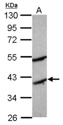 Western Blot: MOGAT2 Antibody [NBP2-19377] - Sample (30 ug of whole cell lysate) A: Raji 10% SDS PAGE gel, diluted at 1:3000.