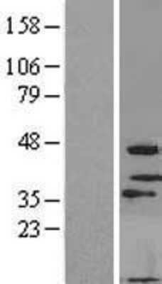Western Blot MOGAT3 Overexpression Lysate