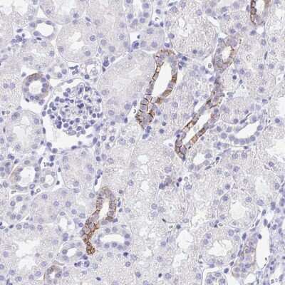 Immunohistochemistry: MON1A Antibody [NBP2-31565] - Staining of human kidney shows strong membranous positivity in renal tubules.