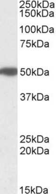 Western Blot: MON1A Antibody [NBP1-52007] - MON1A in human Pancreas lysate (35ug protein in RIPA buffer) using NBP1-52007 at 1 ug/ml. Primary incubation was 1 hour. Detected by chemiluminescence.