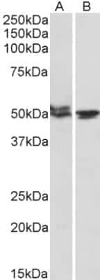 Western Blot: MON1A Antibody [NBP1-52007] - Analysis of Mouse (A) and Rat (B) Testis lysates (35 ug protein in RIPA buffer). Primary incubation was 1 hour. Detected by chemiluminescence.
