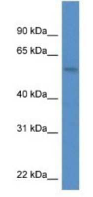 Western Blot: MON1A Antibody [NBP1-74123] - PANC1 Cell Lysate 1ug/ml  Gel Concentration 12%