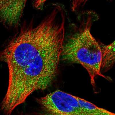 Immunocytochemistry/Immunofluorescence: MON1B Antibody [NBP1-92131] - Staining of human cell line U-251 MG shows localization to cytosol. Antibody staining is shown in green.