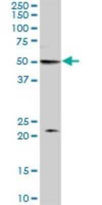 Western Blot: MON1B Antibody [H00022879-B01P] - Analysis of MON1B expression in human kidney.