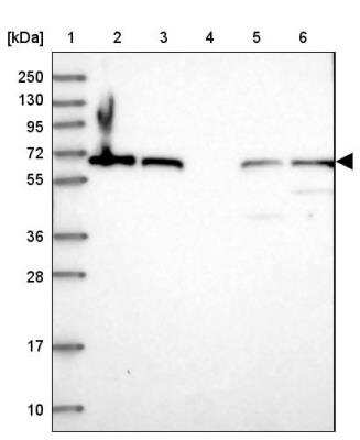 Western Blot: MON1B Antibody [NBP1-92131] - Lane 1: Marker  [kDa] 250, 130, 95, 72, 55, 36, 28, 17, 10.  Lane 2: Human cell line RT-4.  Lane 3: Human cell line U-251MG sp.  Lane 4: Human plasma (IgG/HSA depleted).  Lane 5: Human liver tissue.  Lane 6: Human tonsil tissue