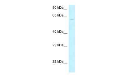 Western Blot: MON1B Antibody [NBP2-85303] - WB Suggested Anti-MON1B Antibody. Titration: 1.0 ug/ml. Positive Control: Hela Whole CellMON1B is supported by BioGPS gene expression data to be expressed in HeLa