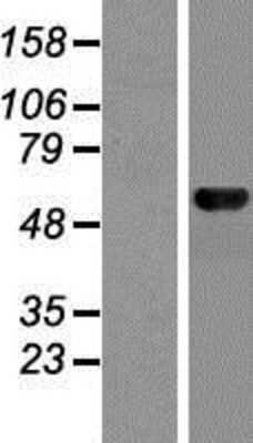 Western Blot: MON1B Overexpression Lysate (Adult Normal) [NBP2-07240] Left-Empty vector transfected control cell lysate (HEK293 cell lysate); Right -Over-expression Lysate for MON1B.