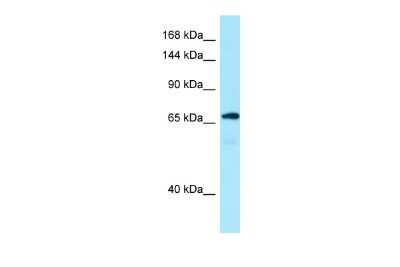 Western Blot: MON2 Antibody [NBP2-83219] - WB Suggested Anti-MON2 Antibody. Titration: 1.0 ug/ml. Positive Control: Fetal Kidney