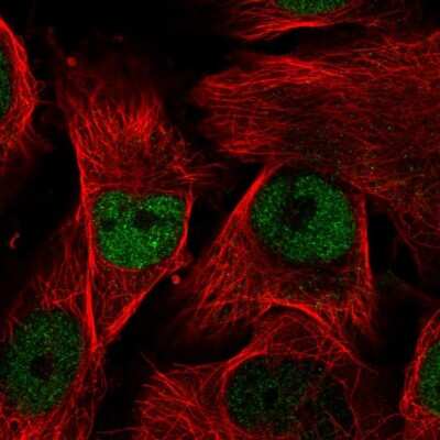 <b>Orthogonal Strategies Validation. </b>Immunocytochemistry/Immunofluorescence: MORC2 Antibody [NBP1-89295] - Staining of human cell line U-251 MG shows localization to nucleoplasm. Antibody staining is shown in green.