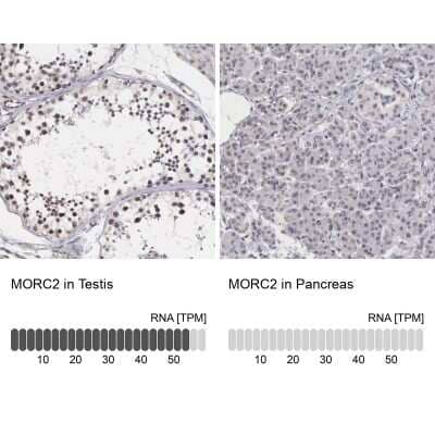 Immunohistochemistry-Paraffin: MORC2 Antibody [NBP1-89295] - Staining in human testis and pancreas tissues using anti-MORC2 antibody. Corresponding MORC2 RNA-seq data are presented for the same tissues.