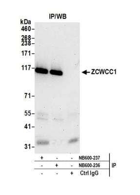 <b>Independent Antibodies Validation. </b>Immunoprecipitation: MORC2 Antibody [NB600-236] - Detection of human MORC2 (ZCWCC1) by western blot of immunoprecipitates. Samples: Whole cell lysate (1.0 mg per IP reaction; 20% of IP loaded) from HeLa cells prepared using NETN lysis buffer. Antibodies: Affinity purified rabbit anti-MORC2 antibody NB600-236 used for IP at 3 ug per reaction. MORC2 was also immunoprecipitated by rabbit anti-MORC2 antibody NB600-237. For blotting immunoprecipitated MORC2, NB600-236 was used at 1 ug/ml. Detection: Chemiluminescence with an exposure time of 30 seconds.