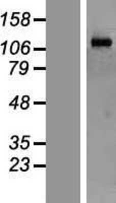 Western Blot: MORC2 Overexpression Lysate (Adult Normal) [NBL1-13181] Left-Empty vector transfected control cell lysate (HEK293 cell lysate); Right -Over-expression Lysate for MORC2.
