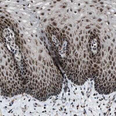 Immunohistochemistry-Paraffin: MORC3 Antibody [NBP1-83036] - Staining of human esophagus shows nuclear and cytoplasmic positivity in squamous epithelial cells.