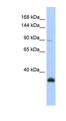 Western Blot: MORC3 Antibody [NBP1-53029] - Jurkat cell lysate, concentration 0.2-1 ug/ml.