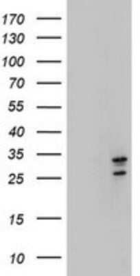 Western Blot: MORF4 Antibody (OTI5F2) - Azide and BSA Free [NBP2-72769] - Analysis of HEK293T cells were transfected with the pCMV6-ENTRY control (Left lane) or pCMV6-ENTRY MORF4.
