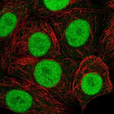 Immunocytochemistry/Immunofluorescence: MORF4L2 Antibody [NBP2-58131] - Staining of human cell line MCF7 shows localization to nucleus. Antibody staining is shown in green. 