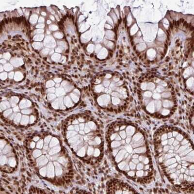 Immunohistochemistry-Paraffin: MORF4L2 Antibody [NBP2-47370] - Staining of human colon tissue. Shows strong nuclear positivity in glandular cells with additional cytoplasmic staining in endothelial cells and peripheral nerve/ganglion.