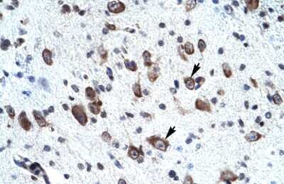 Immunohistochemistry-Paraffin: MORF4L2 Antibody [NBP2-87816] - Paraffin Embedded Tissue: Human neural cell. Cellular Data: Epithelial cells of renal tubule. Antibody Concentration: 4.0-8.0 ug/ml. Magnification: 400X