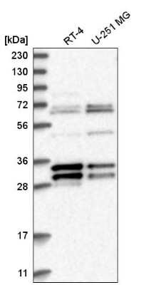 Western Blot: MORF4L2 Antibody [NBP2-58131] - Analysis in human cell line RT-4 and human cell line U-251 MG.