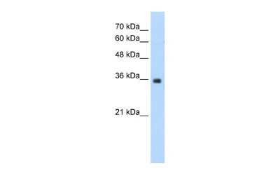 Western Blot: MORF4L2 Antibody [NBP2-87815] - WB Suggested Anti-MORF4L2 Antibody Titration: 1.25ug/ml. Positive Control: HepG2 cell lysate