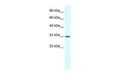 Western Blot: MORF4L2 Antibody [NBP2-87816] - WB Suggested Anti-MORF4L2 Antibody Titration: 0.2ug/ml. Positive Control: Human brain