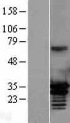 Western Blot: MORF4L2 Overexpression Lysate (Adult Normal) [NBL1-13184] Left-Empty vector transfected control cell lysate (HEK293 cell lysate); Right -Over-expression Lysate for MORF4L2.