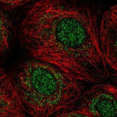 Immunocytochemistry/Immunofluorescence: MORN1 Antibody [NBP1-94013] - Staining of human cell line MCF7 shows localization to nucleus, nucleoli & mitochondria. Antibody staining is shown in green.