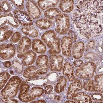 Immunohistochemistry: MORN1 Antibody [NBP2-49643] - Staining of human kidney shows strong cytoplasmic positivity in renal tubules.