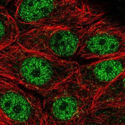 Immunocytochemistry/Immunofluorescence: MORN2 Antibody [NBP2-34193] - Staining of human cell line MCF7 shows localization to nucleoplasm. Antibody staining is shown in green. 
