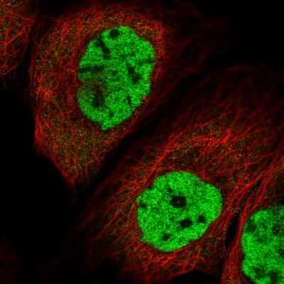 Immunocytochemistry/Immunofluorescence: MORN3 Antibody [NBP2-31007] - Immunofluorescent staining of human cell line A-431 shows localization to nucleoplasm.