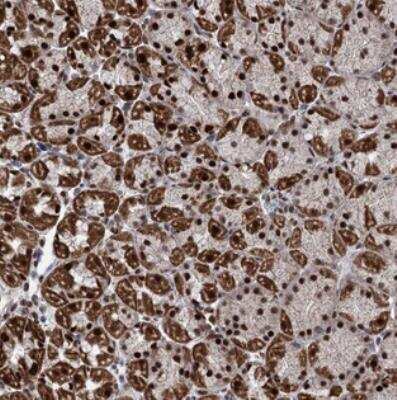 Immunohistochemistry: MORN3 Antibody [NBP2-31007] - Staining of human stomach, lower shows strong nuclear and granular cytoplasmic positivity in glandular cells.